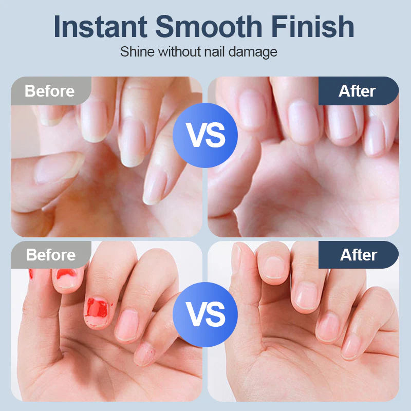 Electric Nail Clipper – Final 4 Hours: 50%OFF 🔥 | Automatic, Silent, USB Rechargeable Nail Trimmer